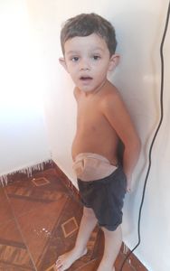 Vaquinha Online - Cirurgia do Mikhael 