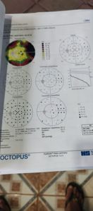 Belo Horizonte/MG - Vaquinha do bem (cirurgia nos olhos)