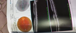 Vaquinha do bem (cirurgia nos olhos) imagem 10