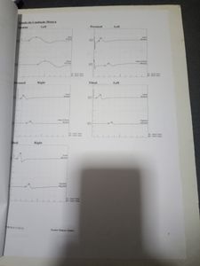 Garibaldi/RS - Recuperação 