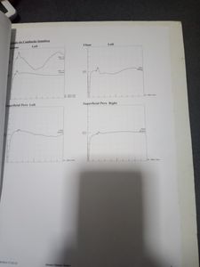 Jussara - Recuperação 