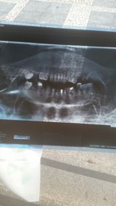 Vaquinha Online - Autoestima