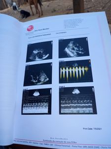 Buritis/RO - Ajuda pro meu filho luiz henryque nasceu com sopro