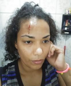 Causas e Comunidade - Não a violência doméstica