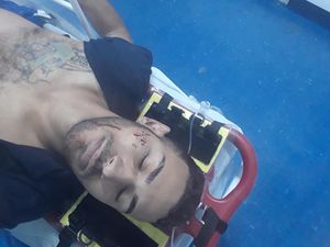 Saúde e Emergências - Sofri acidente e não consigo mais trabalhar 