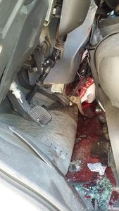 Meu próprio negócio  - Sofri acidente e não consigo mais trabalhar 