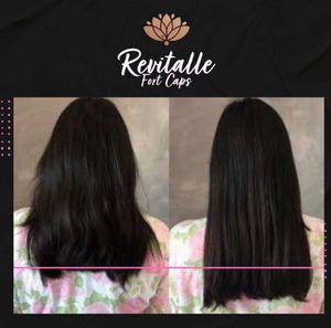 Queimadas/PB - REVITALLE funciona mesmo? 