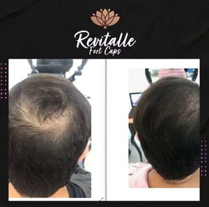 Saúde e Emergências - REVITALLE funciona mesmo? 