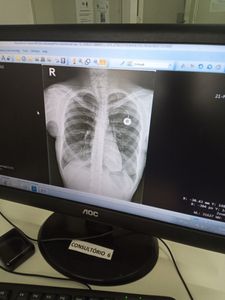 Rafaele  - Ajude Rafaele a conseguir o tratamento e aparelho 