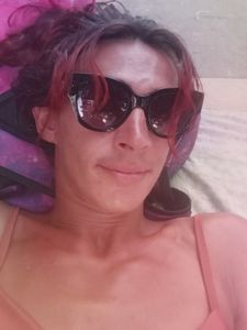 Saúde e Emergências - Travesti sem dignidade  pede ajuda 