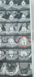 Marialva/PR - Ajudem na recuperação do Vagner o "Vavá'!