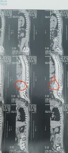 Caridade e Filantropia - Ajudem na recuperação do Vagner o "Vavá'!
