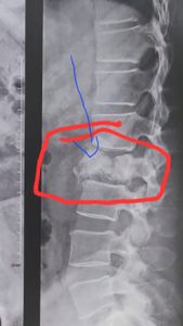 Ajudem na recuperação do Vagner o "Vavá'! imagem 7