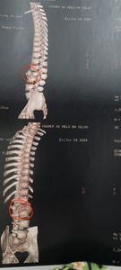 Vagner Melo - Vavá  - Ajudem na recuperação do Vagner o "Vavá'!