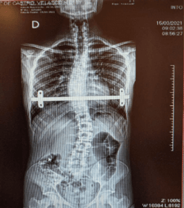 Vaquinha Online - Yago precisa de sua ajuda