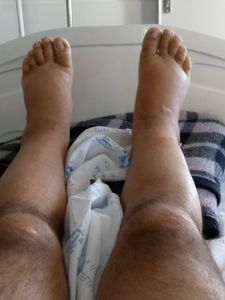 Help Raimundo with his medical expenses and put a roof over his head imagem 10