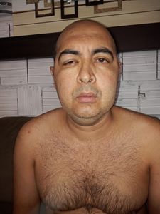 Help Raimundo with his medical expenses and put a roof over his head imagem 8