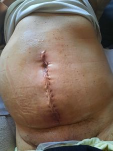 Vaquinha Online - Mãe com câncer 