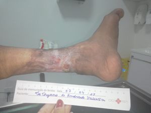 Vaquinha Online - Campanha pela cura de Tathyana