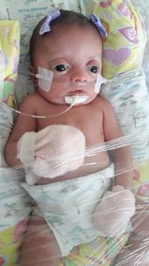 Vaquinha Online - #TODOS-PELA-MANU-RARA 