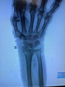 Crowdfunding - Ajuda a minha mãe de 83 anos que tem vários problemas de saúde e si tem eu único filho não abandonou e cuida dela ,a se tratar artrose, fraturas e fisioterapia por favor .pix marcos1boy@gmail.com