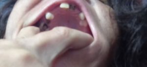 Vaquinha Online - Tratamento dentario e proteses