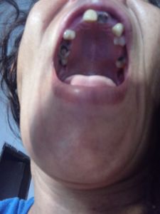 Caridade e Filantropia - Tratamento dentario e proteses