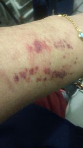 Vaquinha Online - Ajude a Irmã Zípora!