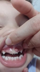 Vaquinha Online - JUNTOS PELO SORRISO DA MARIA ALICE 