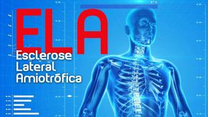 Amigos do bem (Um por todos e todos por um)