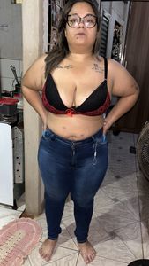 Reparadoras pos bariatrica