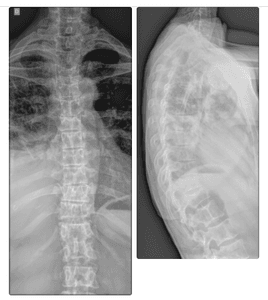 Vaquinha Online - Cirurgia da Ju