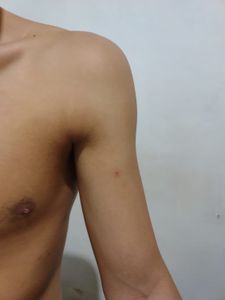 Belém/PA - comprar um celular após roubo