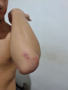 Vaquinha Online - comprar um celular após roubo