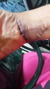 Vaquinha - SOS RAQUEL